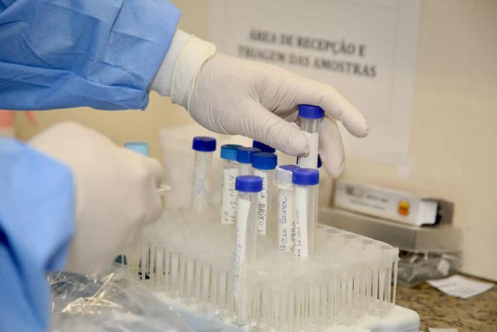 Ampolas com amostras do vírus sendo manipuladas por técnico do Instituto Adolfo Lutz. 