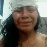 Jovem Aline de Souza durante vídeo. Aparece com o rosto com ferimentos e cabeça enfaixada.