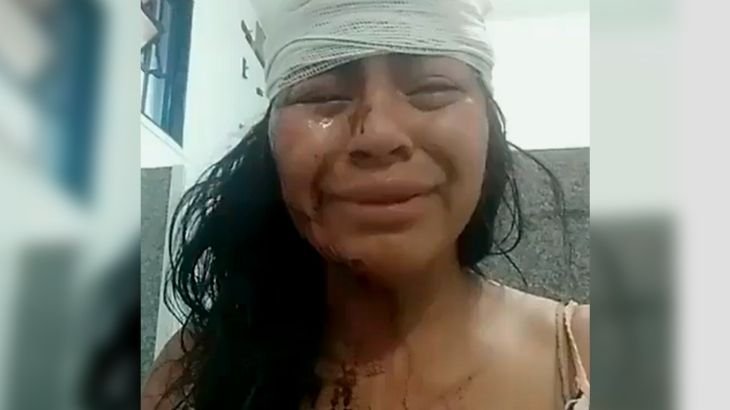 Jovem Aline de Souza durante vídeo. Aparece com o rosto com ferimentos e cabeça enfaixada.