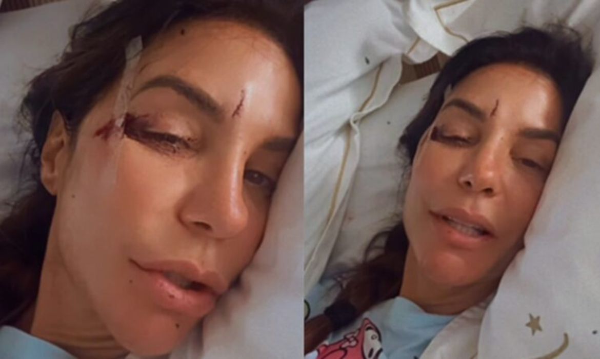 Ivete Sangalo é hospitalizada após queda e tranquiliza fãs nas redes sociais